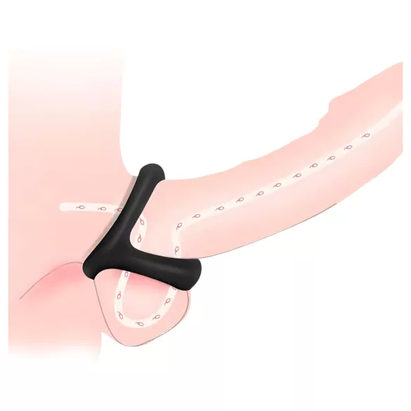 Penisrõngas ja munandirõngas - tekstuurne pind - must